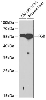 FGB Polyclonal Antibody (E-AB-60304)