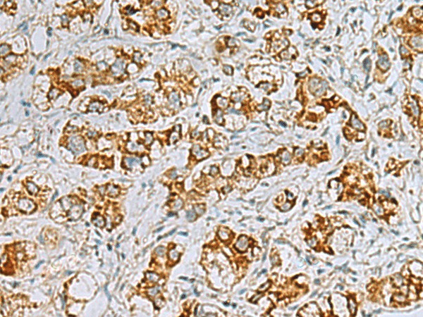 FAAP100 Polyclonal Antibody (E-AB-19883)