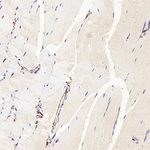 CD31 Polyclonal Antibody (E-AB-70021)