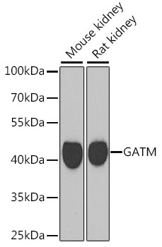 GATM Polyclonal Antibody (E-AB-61238)