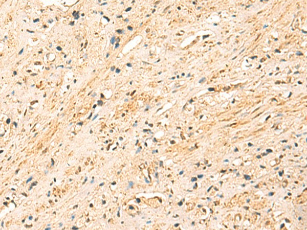 EEF1AKMT2 Polyclonal Antibody (E-AB-18929)