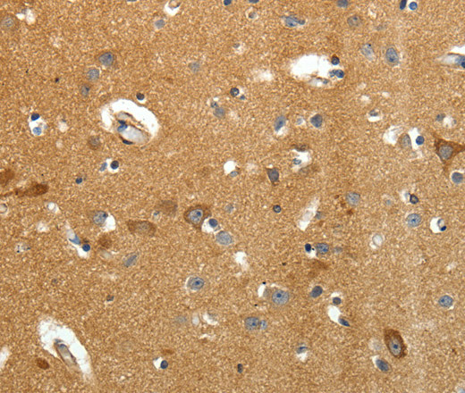 AMD1 Polyclonal Antibody (E-AB-12857)
