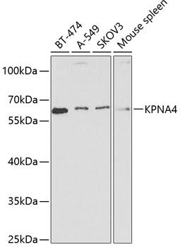 KPNA4 Polyclonal Antibody (E-AB-60561)