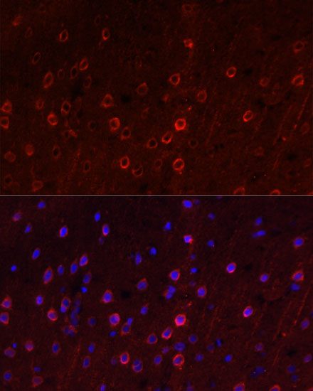 SLC1A1 Polyclonal Antibody (E-AB-67504)