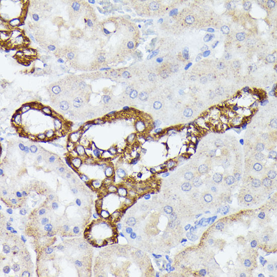 LTF Polyclonal Antibody (E-AB-65979)