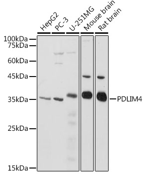 PDLIM4 Polyclonal Antibody (E-AB-92248)