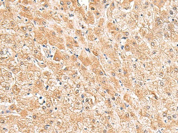 TRUB1 Polyclonal Antibody (E-AB-18992)