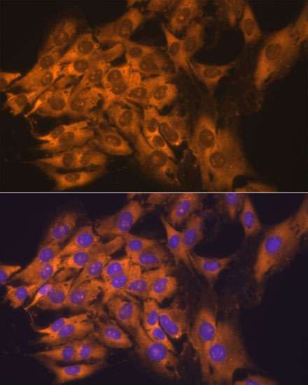 RPL17 Polyclonal Antibody (E-AB-62202)
