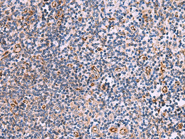 ITGA11 Polyclonal Antibody (E-AB-18136)