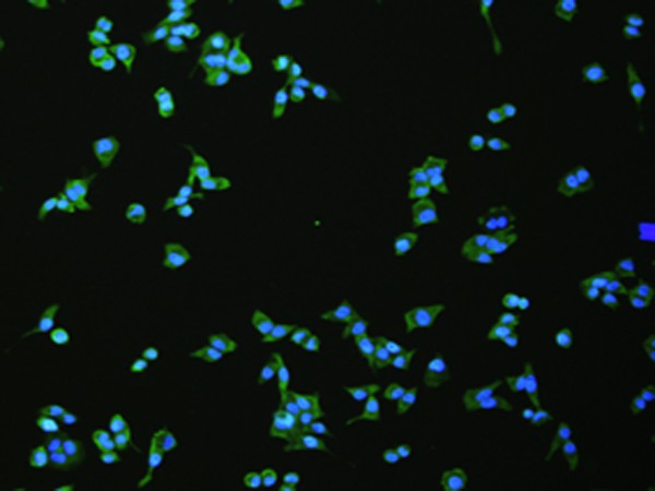 FLT4 Polyclonal Antibody (E-AB-53195)