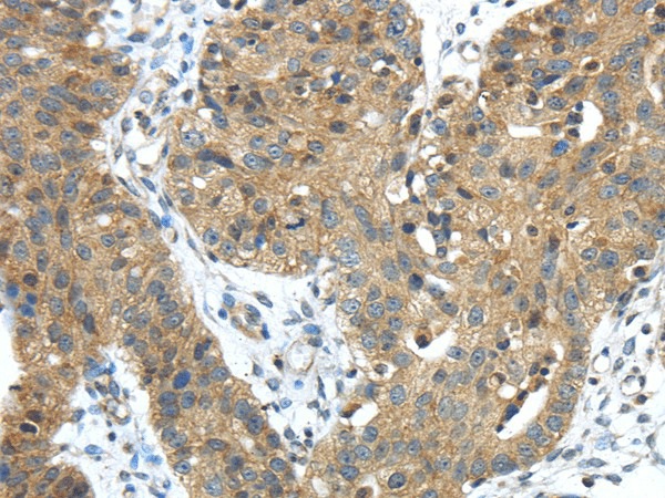 TMPRSS11E Polyclonal Antibody (E-AB-17117)