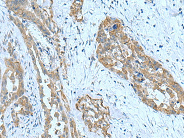 SRPK2 Polyclonal Antibody (E-AB-19091)