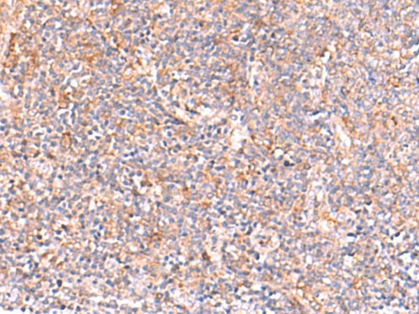 NADK Polyclonal Antibody (E-AB-52957)
