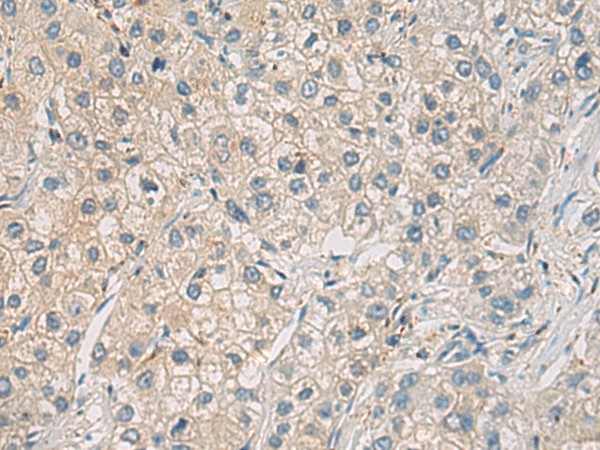 WFDC3 Polyclonal Antibody (E-AB-19581)