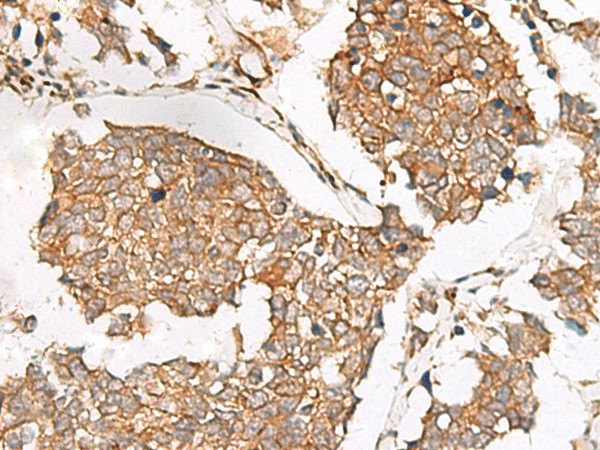 SLC40A1 Polyclonal Antibody (E-AB-19866)