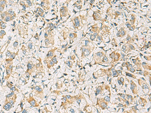 PDE4DIP Polyclonal Antibody (E-AB-19222)