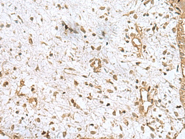 AK6 Polyclonal Antibody (E-AB-53058)