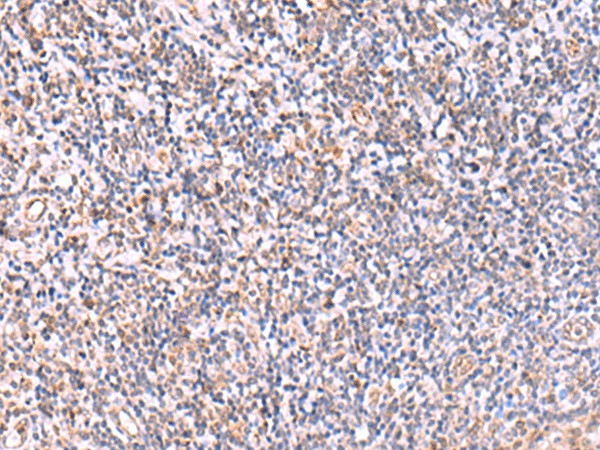 ITPKC Polyclonal Antibody (E-AB-18123)
