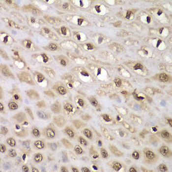 INTS5 Polyclonal Antibody (E-AB-64772)
