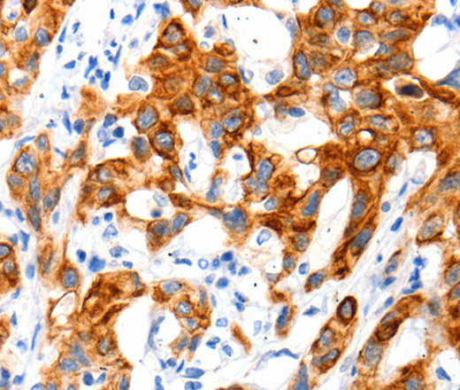 SLC2A11 Polyclonal Antibody (E-AB-12479)