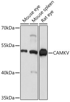 CAMKV Polyclonal Antibody (E-AB-91731)