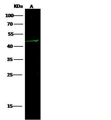 Recombinant Gastric intrinsic factor/GIF Monoclonal Antibody (AN300441P)