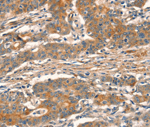 CUEDC2 Polyclonal Antibody (E-AB-11111)