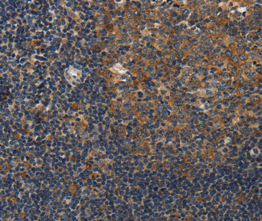 DSP Polyclonal Antibody (E-AB-15605)