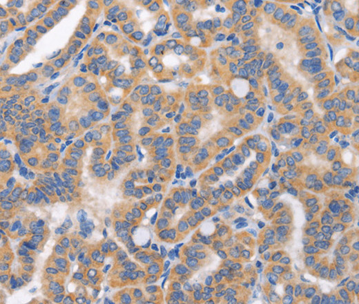 CARD17 Polyclonal Antibody (E-AB-16299)