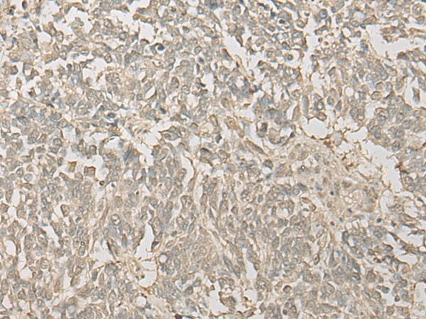 FYTTD1 Polyclonal Antibody (E-AB-18680)
