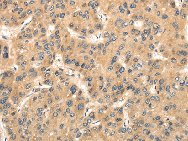TTC23 Polyclonal Antibody (E-AB-17167)