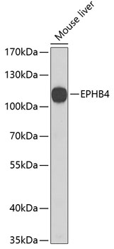 EPHB4 Polyclonal Antibody (E-AB-62074)