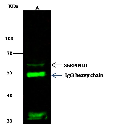 Recombinant SerpinD1/HCII Monoclonal Antibody (AN300478P)