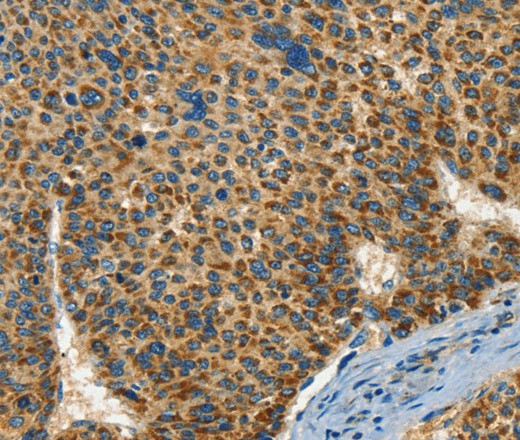 IFT74 Polyclonal Antibody (E-AB-16349)