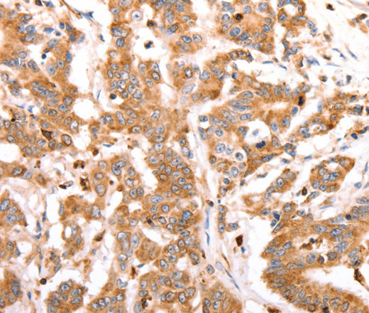 CELSR2 Polyclonal Antibody (E-AB-12931)