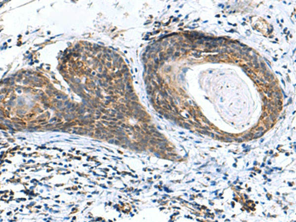 AP1S3 Polyclonal Antibody (E-AB-19098)