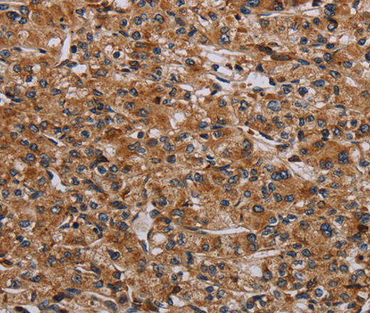 p70 S6 kinase beta Polyclonal Antibody (E-AB-13487)