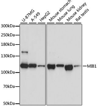 MIB1 Polyclonal Antibody (E-AB-62499)