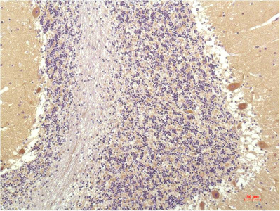 SGK1 Monoclonal Antibody (E-AB-22207)