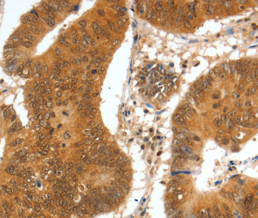 SPDEF Polyclonal Antibody (E-AB-10535)