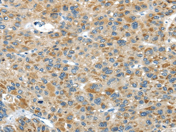 USP9X Polyclonal Antibody (E-AB-17534)