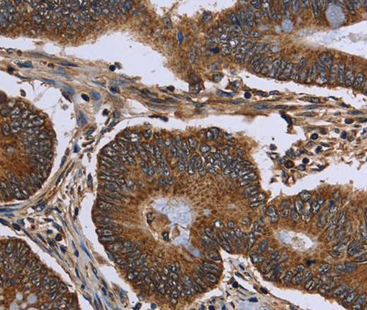FHIT Polyclonal Antibody (E-AB-15035)