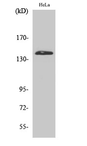 PERK Polyclonal Antibody (E-AB-32546)