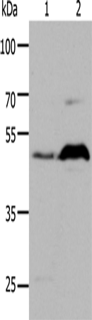 HTR1A Polyclonal Antibody (E-AB-12217)