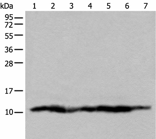 UQCRQ Polyclonal Antibody (E-AB-18511)
