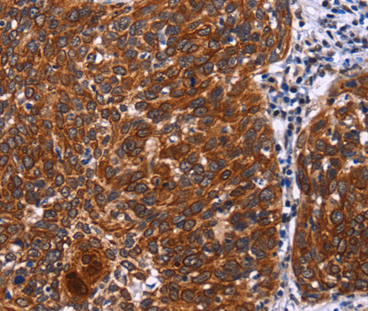 USP2 Polyclonal Antibody (E-AB-10878)