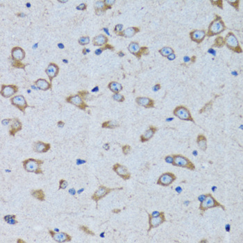 RARS Polyclonal Antibody (E-AB-61876)