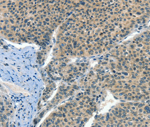 CRLF2 Polyclonal Antibody (E-AB-16351)