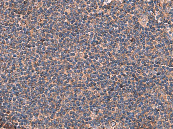 ITGA11 Polyclonal Antibody (E-AB-52048)
