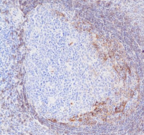 Recombinant CD23 Monoclonal Antibody (AN301471L)
